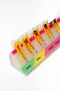 MODELO PROGRESIÓN DE CARIES