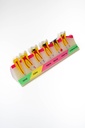 MODELO PROGRESIÓN DE CARIES