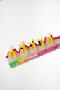 MODELO PROGRESIÓN DE ENFERMEDAD PERIODONTAL