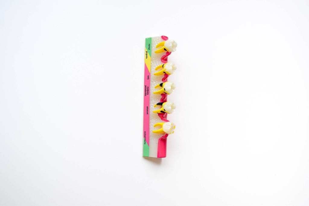 MODELO PROGRESIÓN DE ENFERMEDAD PERIODONTAL