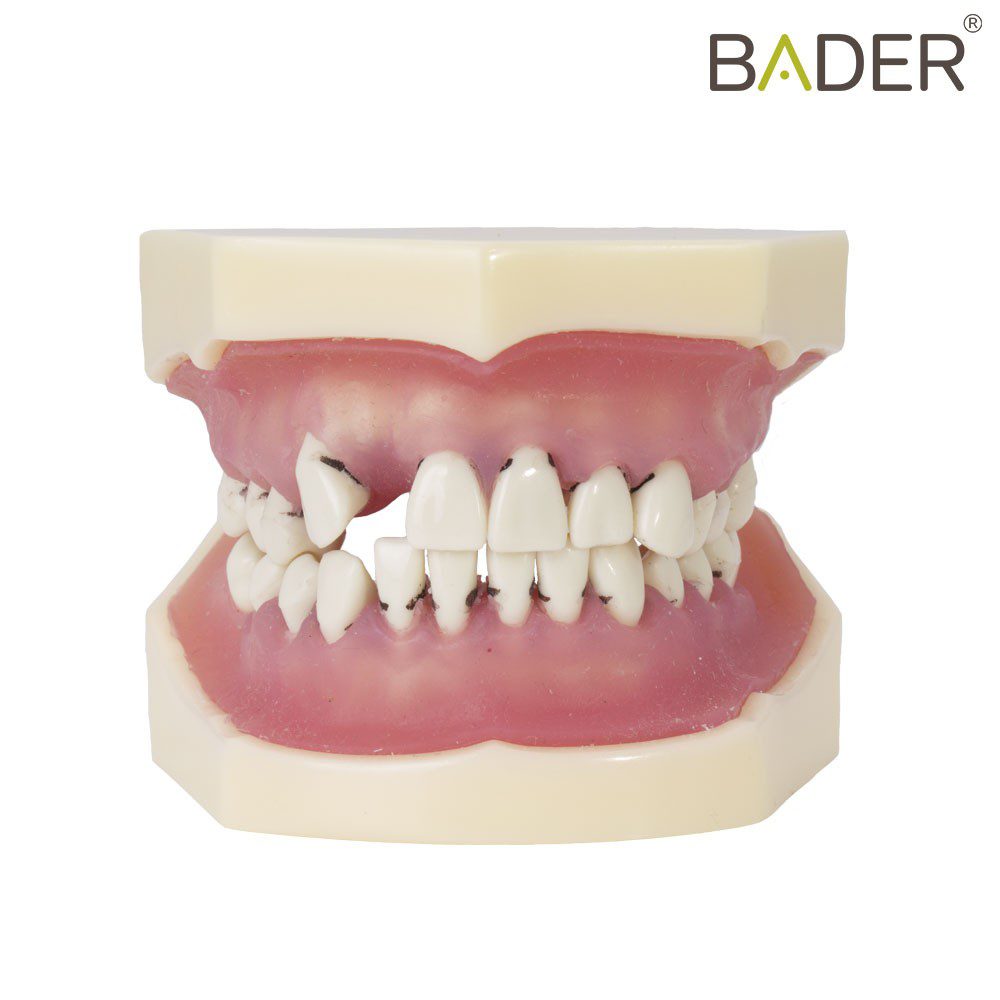 MODELO DE PERIODONCIA
