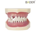 MODELO DE PERIODONCIA