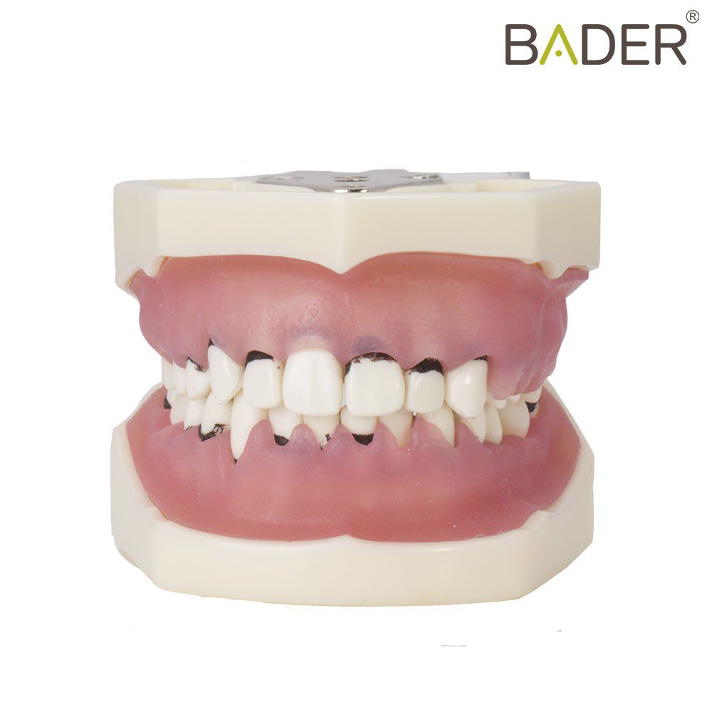 MODELO DE PERIODONCIA CON ARTICULADOR