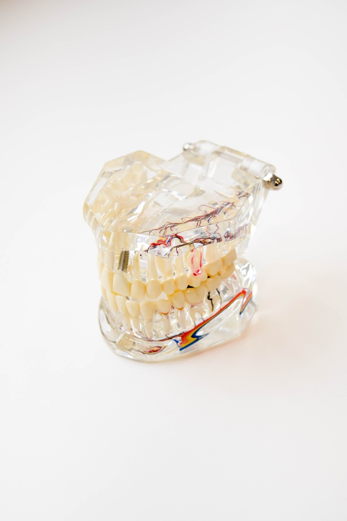 MODELO DENTAL TRANSPARENTE DE IMPLANTE CON NERVIO