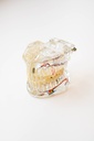 MODELO DENTAL TRANSPARENTE DE IMPLANTE CON NERVIO