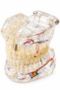 MODELO DENTAL TRANSPARENTE DE IMPLANTE CON NERVIO
