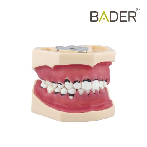 [0905113] MODELO DE PERIODONCIA COMPLETO SIN ARTICULADOR