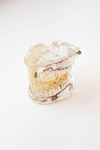 [0905111] MODELO DENTAL TRANSPARENTE DE IMPLANTE CON NERVIO